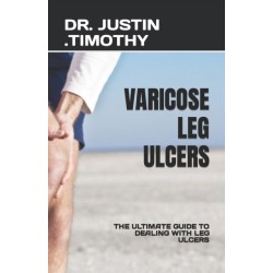 Varicose Leg Ulcers: The Ultimate Guide to Dealing with Leg Ulcers