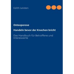 Osteoporose: Handeln bevor der Knochen bricht