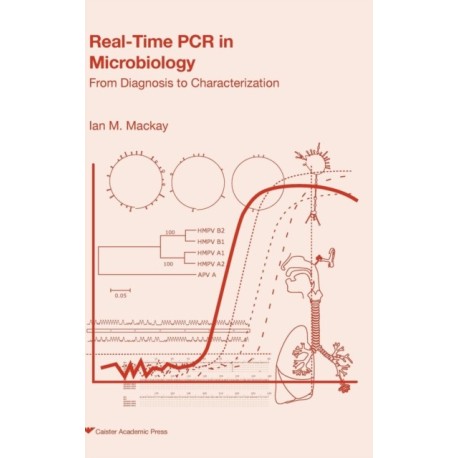 Real-time PCR in Microbiology: From Diagnosis to Characterization