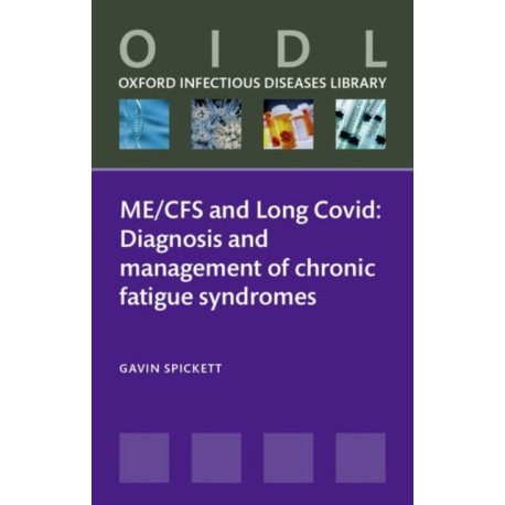 ME/CFS and Long Covid: Diagnosis and management of chronic fatigue syndromes