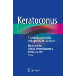 Keratoconus: A Comprehensive Guide to Diagnosis and Treatment