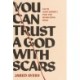 You Can Trust a God with Scars
