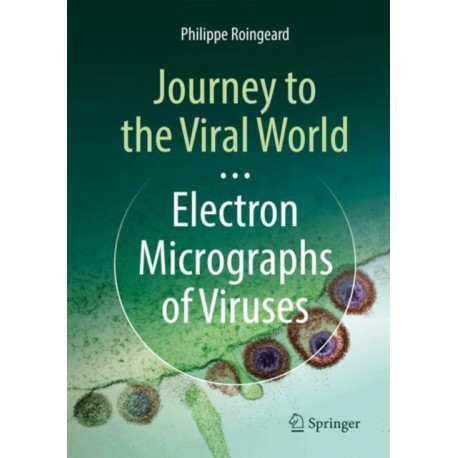 Journey to the Viral World: Electron Micrographs of Viruses