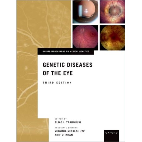 Genetic Diseases of the Eye