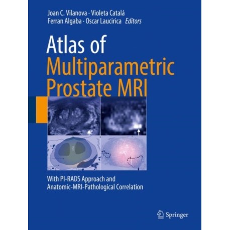 Atlas of Multiparametric Prostate MRI: With PI-RADS Approach and Anatomic-MRI-Pathological Correlation