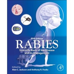 Rabies: Scientific Basis of the Disease and Its Management