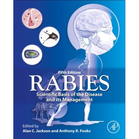 Rabies: Scientific Basis of the Disease and Its Management