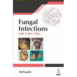 Fungal Infections: with Color Atlas