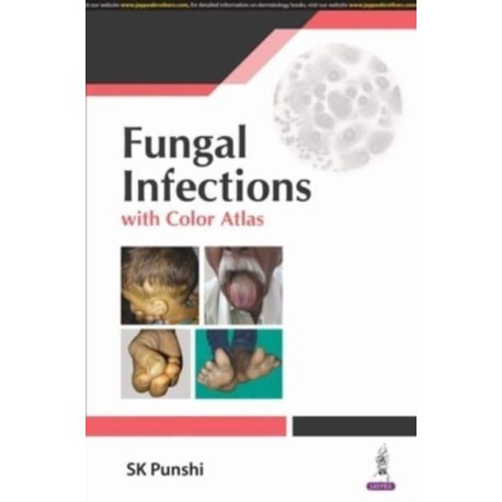 Fungal Infections: with Color Atlas