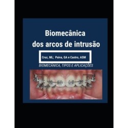 Biomecanica dos Arcos de Intrusao