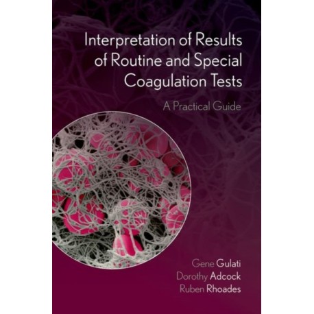 Interpretation of Results of Routine and Special Coagulation Tests: A Practical Guide