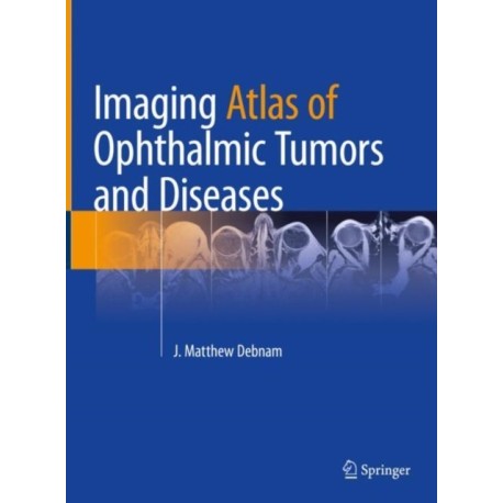 Imaging Atlas of Ophthalmic Tumors and Diseases