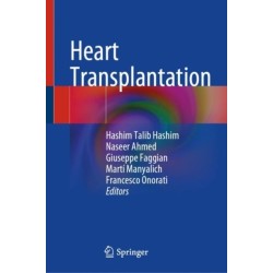 Heart Transplantation