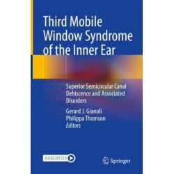Third Mobile Window Syndrome of the Inner Ear: Superior Semicircular Canal Dehiscence and Associated Disorders