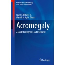 Acromegaly: A Guide to Diagnosis and Treatment