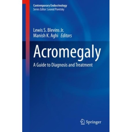 Acromegaly: A Guide to Diagnosis and Treatment
