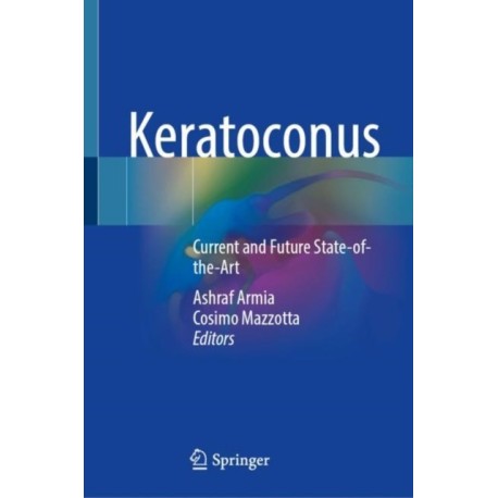 Keratoconus: Current and Future State-of-the-Art