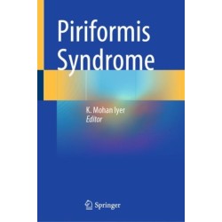 Piriformis Syndrome