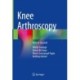 Knee Arthroscopy: How to Succeed