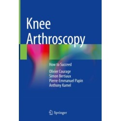 Knee Arthroscopy: How to Succeed