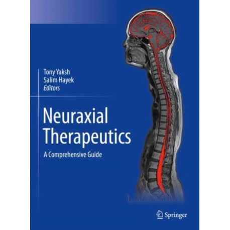 Neuraxial Therapeutics: A Comprehensive Guide