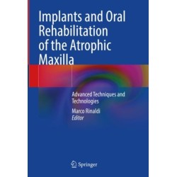 Implants and Oral Rehabilitation of the Atrophic Maxilla: Advanced Techniques and Technologies