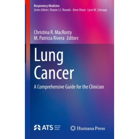 Lung Cancer: A Comprehensive Guide for the Clinician