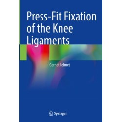 Press-Fit Fixation of the Knee Ligaments