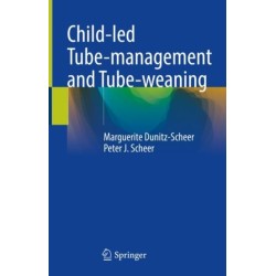 Child-led Tube-management and Tube-weaning