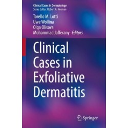 Clinical Cases in Exfoliative Dermatitis
