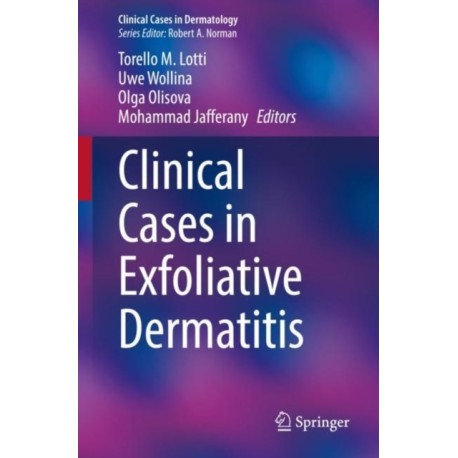 Clinical Cases in Exfoliative Dermatitis