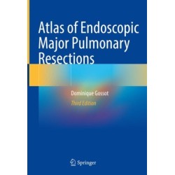 Atlas of Endoscopic Major Pulmonary Resections