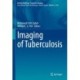 Imaging of Tuberculosis