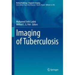 Imaging of Tuberculosis