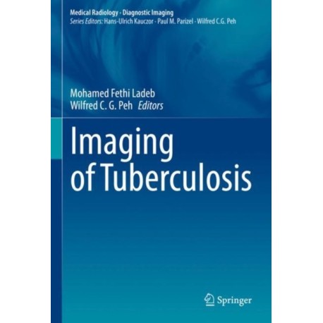 Imaging of Tuberculosis