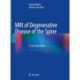 MRI of Degenerative Disease of the Spine: A Case-Based Atlas