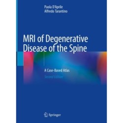 MRI of Degenerative Disease of the Spine: A Case-Based Atlas