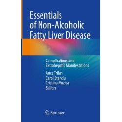 Essentials of Non-Alcoholic Fatty Liver Disease: Complications and Extrahepatic Manifestations