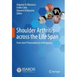 Shoulder Arthritis across the Life Span: From Joint Preservation to Arthroplasty
