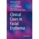 Clinical Cases in Facial Erythema