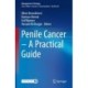 Penile Cancer – A Practical Guide