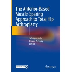 The Anterior-Based Muscle-Sparing Approach to Total Hip Arthroplasty