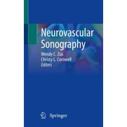 Neurovascular Sonography