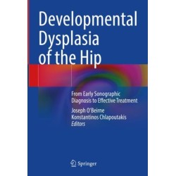 Developmental Dysplasia of the Hip: From Early Sonographic Diagnosis to Effective Treatment