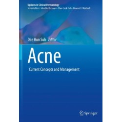 Acne: Current Concepts and Management