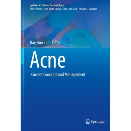 Acne: Current Concepts and Management