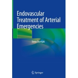 Endovascular Treatment of Arterial Emergencies
