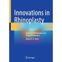 Innovations in Rhinoplasty: Anatomy, Photography and Surgical Techniques