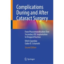 Complications During and After Cataract Surgery: From Phacoemulsification Over Secondary IOL Implantation to Dropped Nucleus