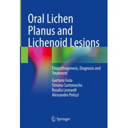 Oral Lichen Planus and Lichenoid Lesions: Etiopathogenesis, Diagnosis and Treatment